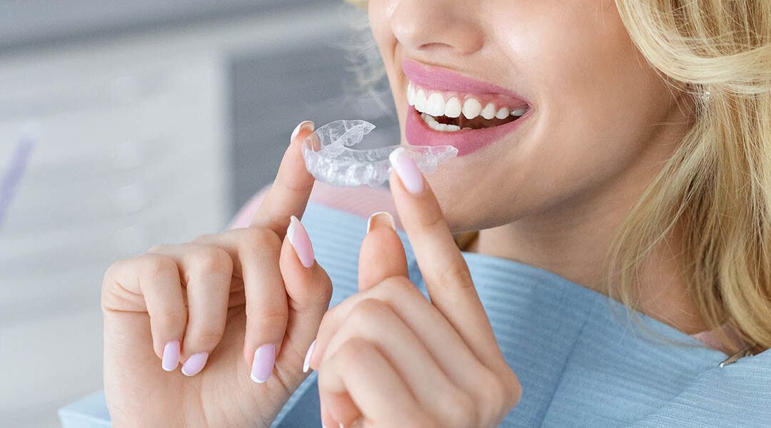 Invisalign Questions and Answers – FAQs