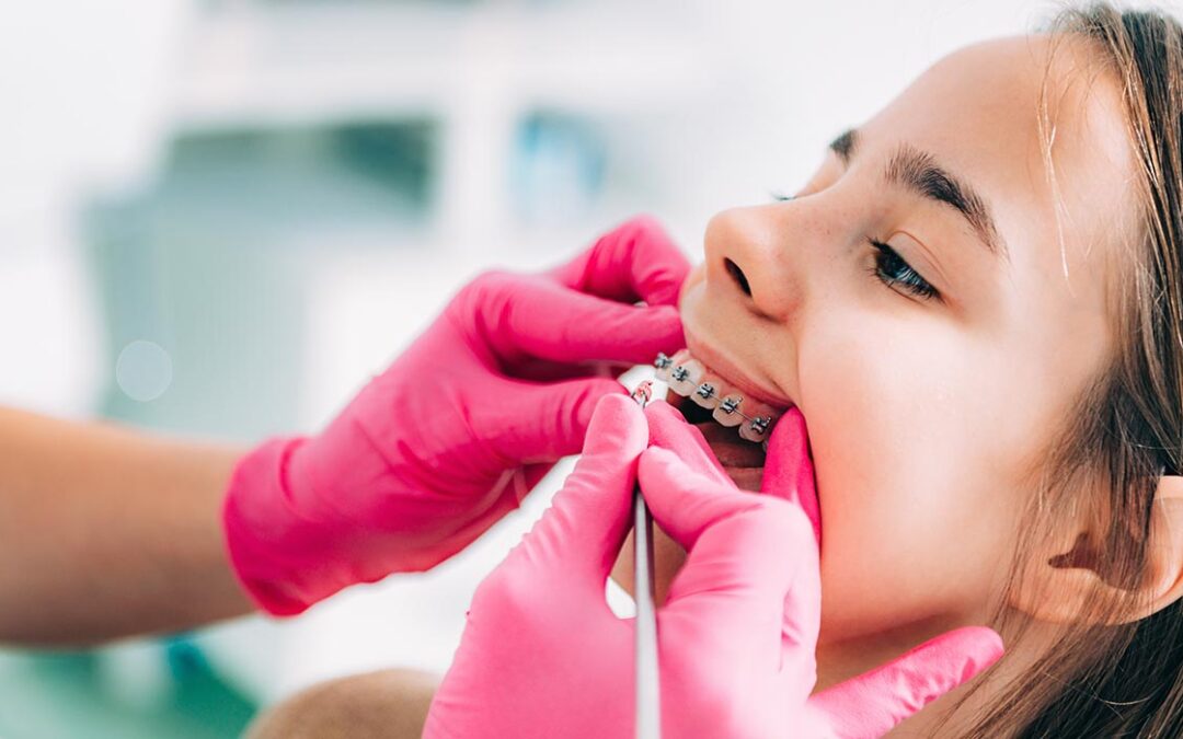 Children's Braces - Orthodontics